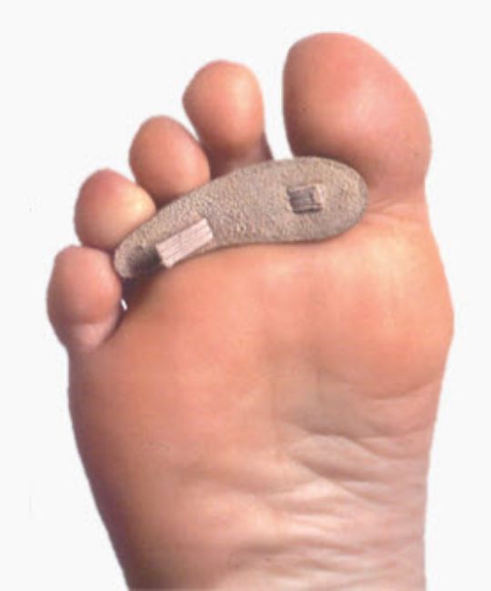 Hammer Toe Crests, Pack of Three